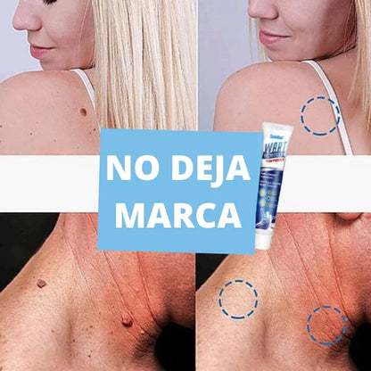 Kit removedor de verrugas: Crema + jabón limpiador